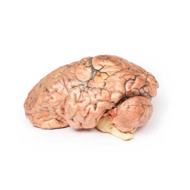 3D Printed Craniopharyngioma