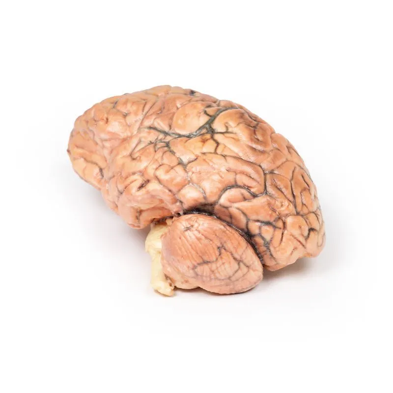 3D Printed Craniopharyngioma