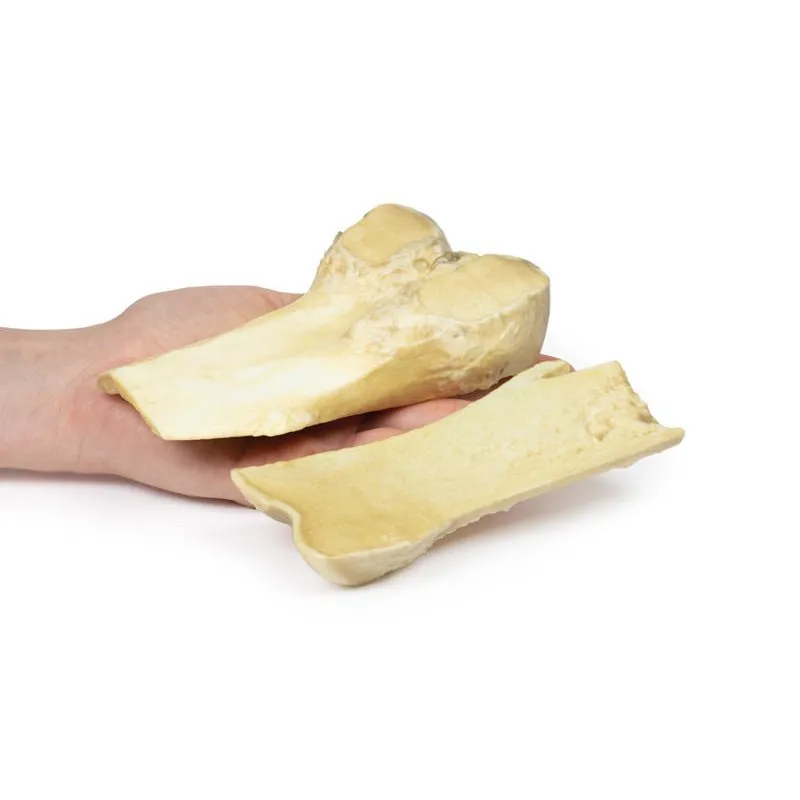 Optimized 3D Printed Model of Osteochondroma for Educational Use
